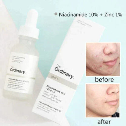 The Ordinary's Niacinamide 10% + Zinc 1% Serum 🅱