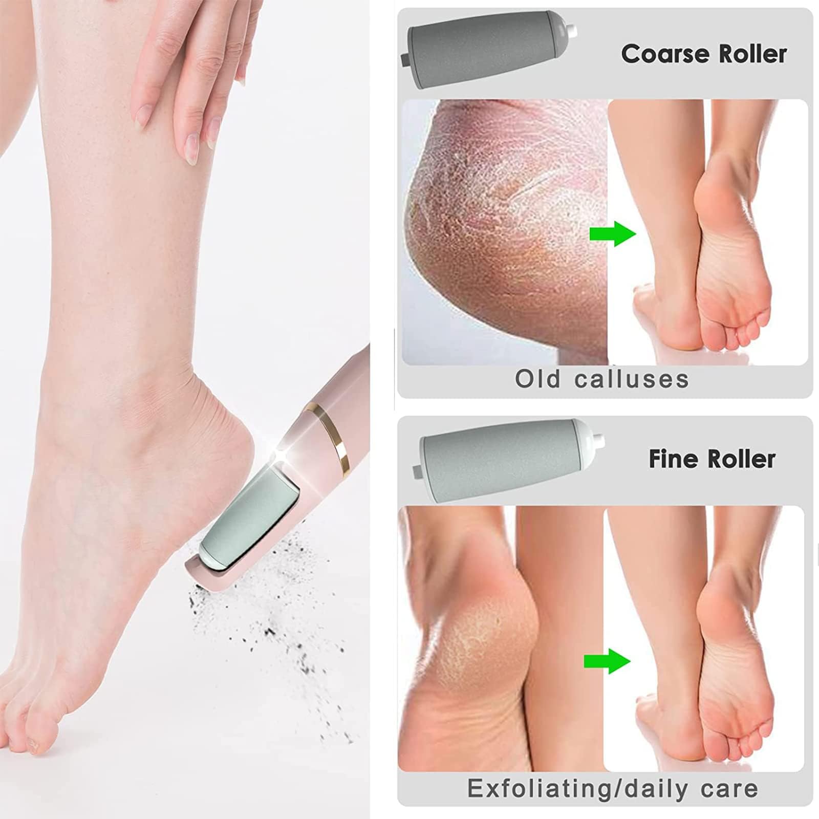 Feet Callus Remover 🅱